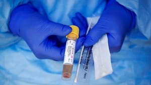 Tænketank: EU advarede forgæves medlemslande om coronavirus 